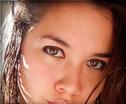 Иньекции ботокса