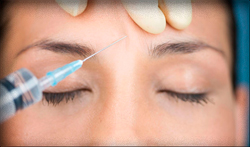 Применение иньекции ботокс